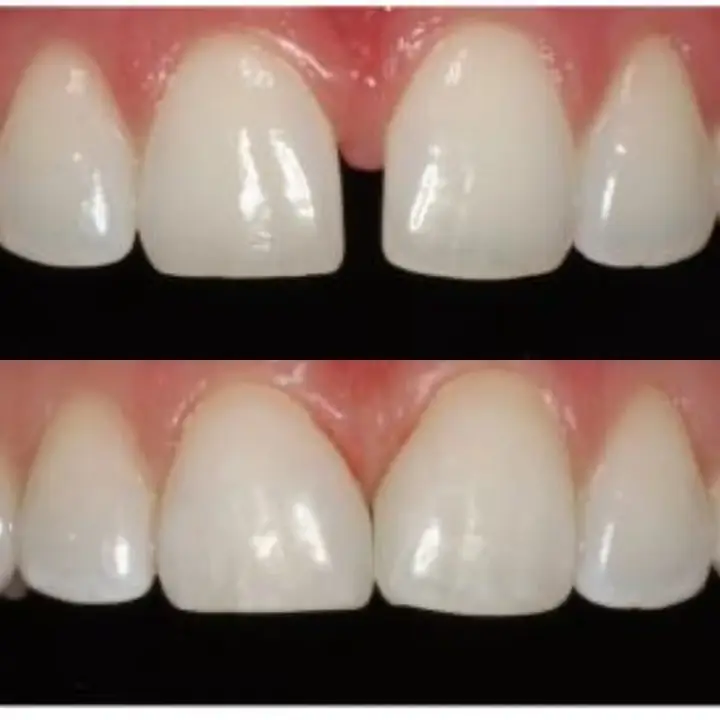 Second finished Perth Dental Rooms image ad
